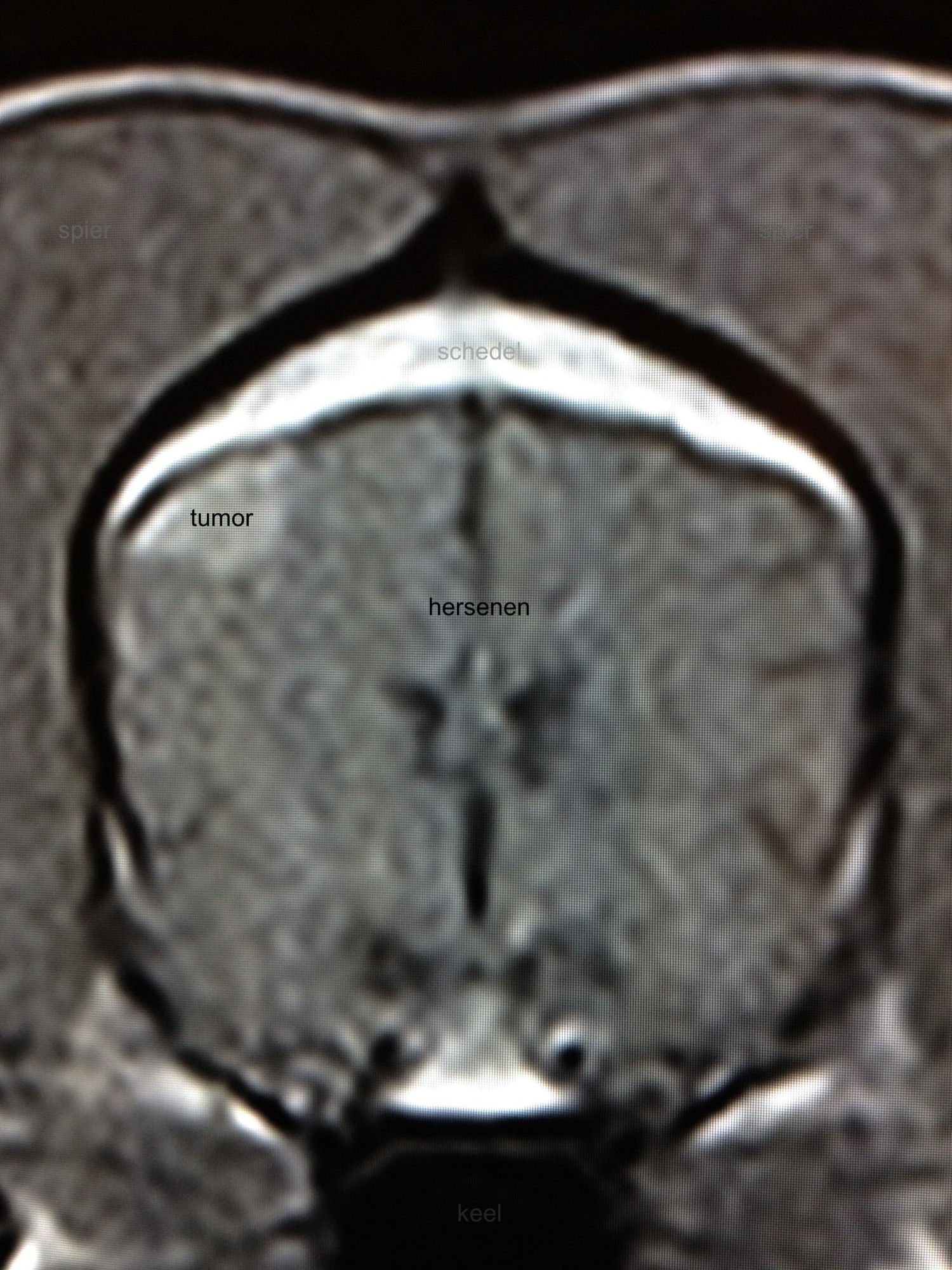 MRI scan hersenen hond